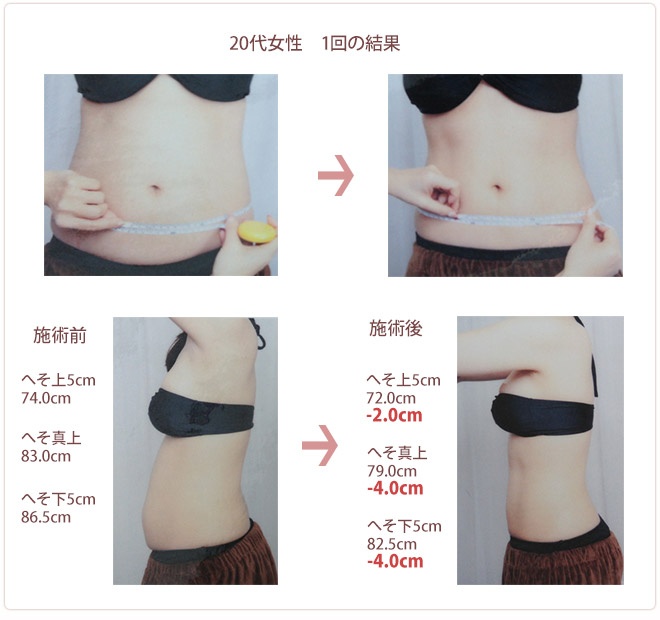 20代女性 一回の結果
