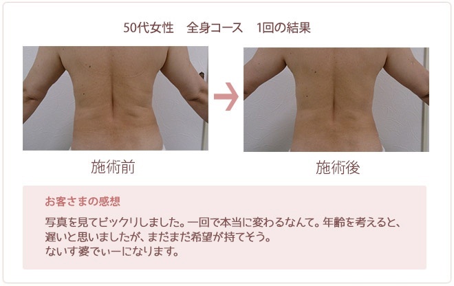50代女性 全身コース 一回の結果